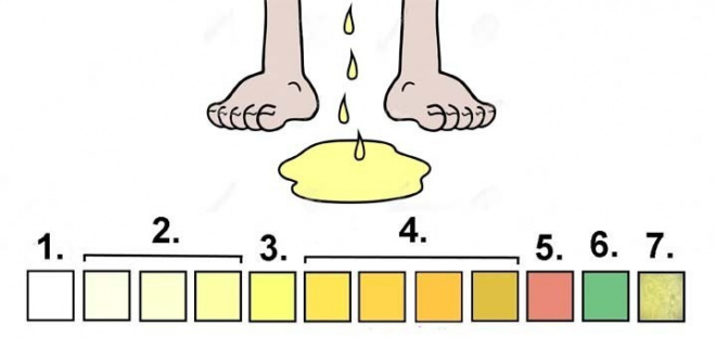 A vizeleted színe ezekről a betegségekről árulkodik?Az alábbi cikkben segítséget adunk ahhoz, hogy a vizelet színei mit árulnak el szervezetünkről és betegségünkről.
